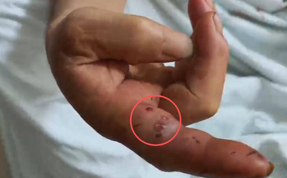 每天捕蛇十七八个小时！广西横州捕蛇者：抓了两千多斤
